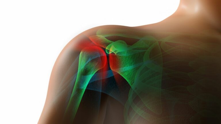 Read more about the article 7 Stretching & Strengthening Exercises for a Frozen Shoulder